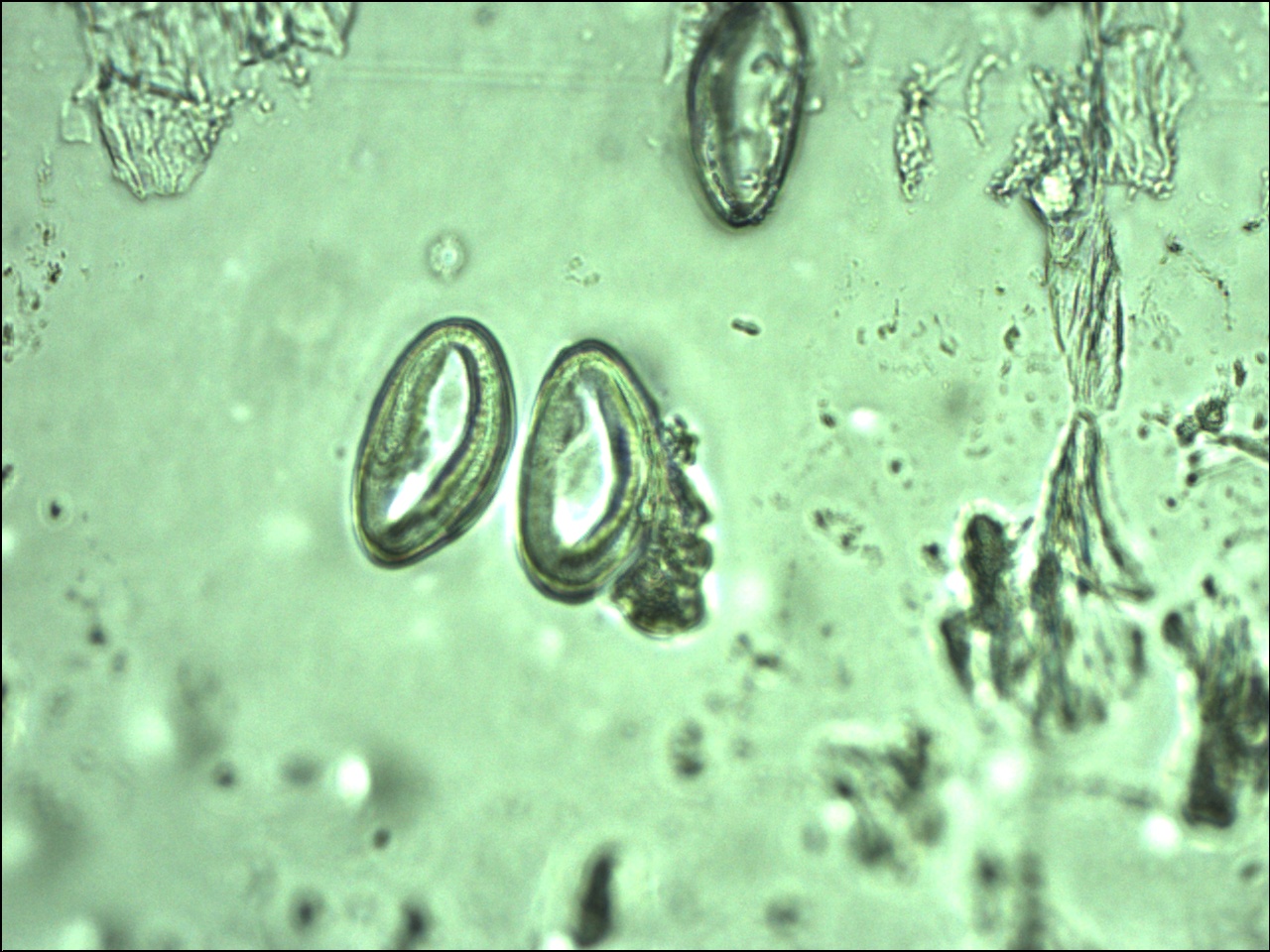 enterobius vermicularis lijecenje
