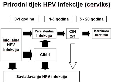 hpv vírus kako nastaje)