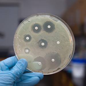 Antimikrobna rezistencija - pitanja i odgovori