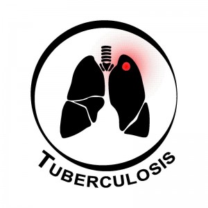 Tuberkuloza (TBC)